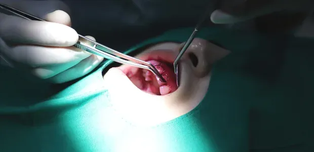刷牙检查