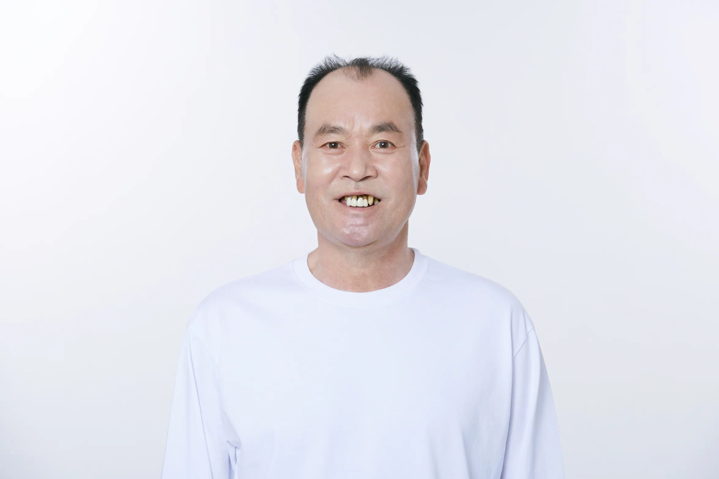 金OO 治疗前照片