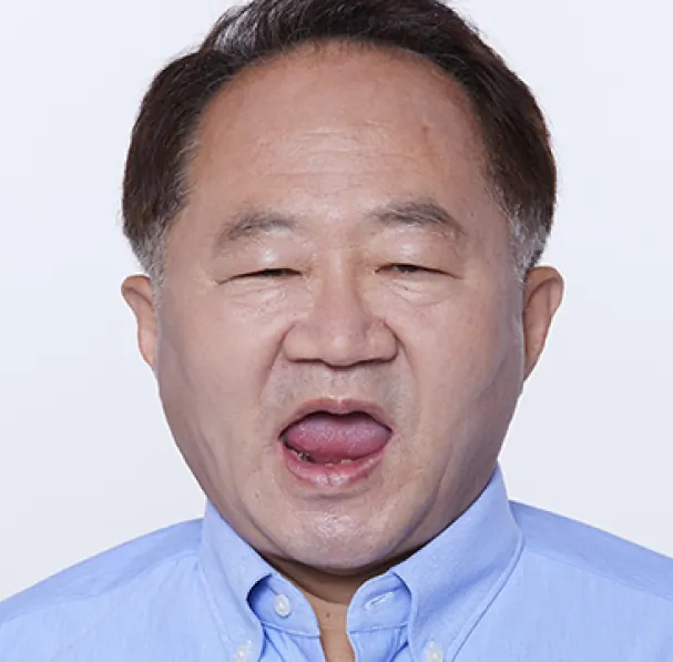 崔**（60多岁） 治疗前