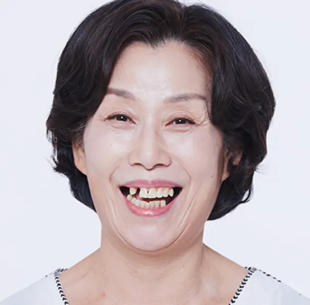 郑**（60多岁） 治疗前
