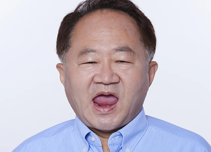 崔OO 治疗前照片